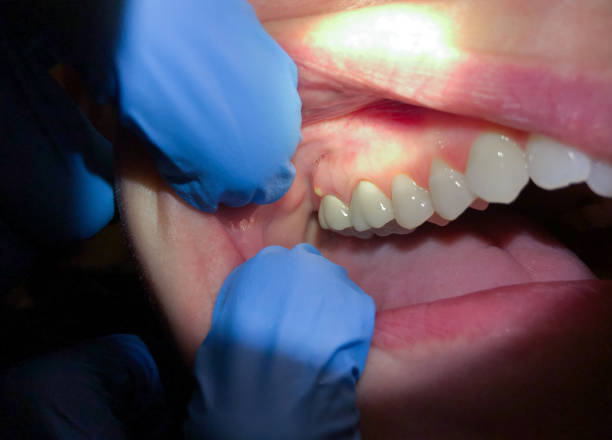 Best 24-Hour Emergency Dentist in Manitou Beach Devils Lake, MI