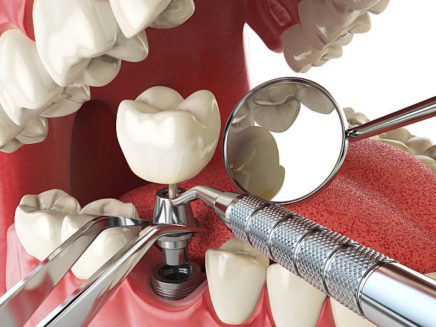 Best Emergency Cosmetic Dentistry in Manitou Beach Devils Lake, MI
